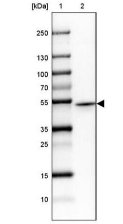 Protein Kinase A regulatory subunit I alpha Antibody, Novus Biologicals:Antibodies:Primary