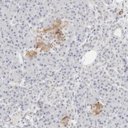 Protein kinase-like protein SgK493 Antibody, Novus Biologicals 25 &mu;L;