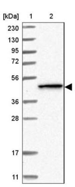 Protein kinase-like protein SgK493 Antibody, Novus Biologicals 25 &mu;L;