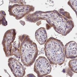 Protein O-Glucosyltransferase 1/POGLUT1/KTELC1 Antibody, Novus Biologicals