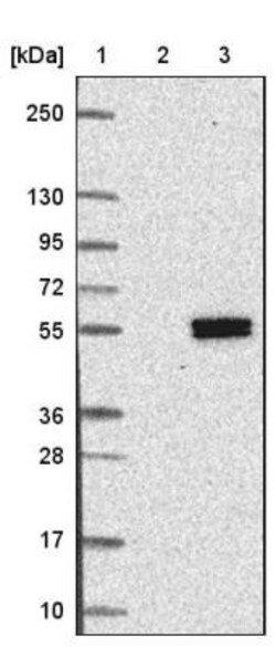 Protein O-Glucosyltransferase 1/POGLUT1/KTELC1 Antibody, Novus Biologicals