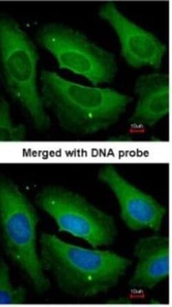 Protein Phosphatase 1C gamma Antibody, Novus Biologicals 0.1mg; Unlabeled:Antibodies,