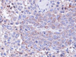 Protein Phosphatase 1C gamma Antibody, Novus Biologicals 0.1mg; Unlabeled:Antibodies,