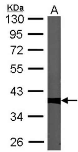 Protein Phosphatase 1C gamma Antibody, Novus Biologicals 0.1mg; Unlabeled:Antibodies,