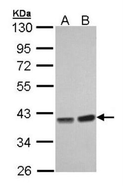 Protein Phosphatase 1C gamma Antibody, Novus Biologicals 0.1mg; Unlabeled:Antibodies,