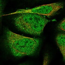 Protein phosphatase 1F Antibody, Novus Biologicals 25 &mu;L; Unlabeled:Antibodies,