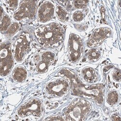 Protein phosphatase 1F Antibody, Novus Biologicals 25 &mu;L; Unlabeled:Antibodies,