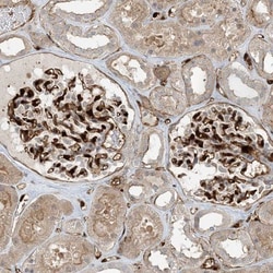 Protein phosphatase 1F Antibody, Novus Biologicals 0.1mL; Unlabeled:Antibodies,