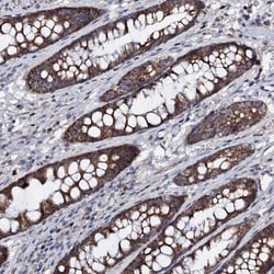 Protein phosphatase 1 inhibitor 3D Antibody, Novus Biologicals 0.1mL; Unlabeled:Antibodies,
