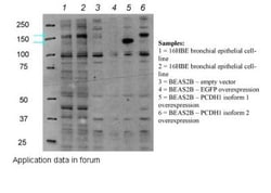 Protocadherin-1 Antibody, Novus Biologicals 0.05mg; Unlabeled:Antibodies,