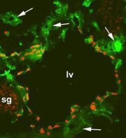 Prox1 Antibody, Novus Biologicals 0.2 mg; Unconjugated:Antibodies, Polyclonal