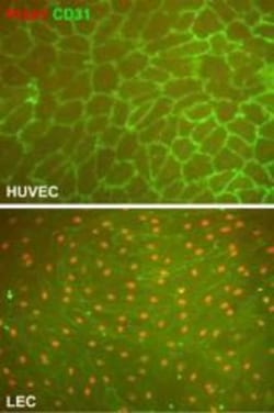 Prox1 Antibody, Novus Biologicals 0.2 mg; Unconjugated:Antibodies, Polyclonal