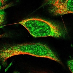 PROX2 Antibody, Novus Biologicals 25 μL, Unlabeled:Antibodies, Polyclonal