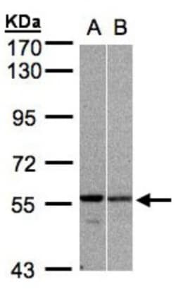 PRP19 Antibody, Novus Biologicals 0.1mL; Unlabeled:Antibodies, Polyclonal