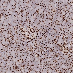 PRPF31 Antibody, Novus Biologicals:Antibodies:Primary Antibodies