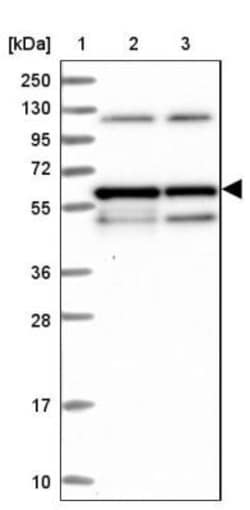 PRPF31 Antibody, Novus Biologicals:Antibodies:Primary Antibodies