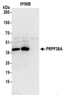 PRPF38A Antibody, Novus Biologicals 0.1mL:Antibodies, Polyclonal