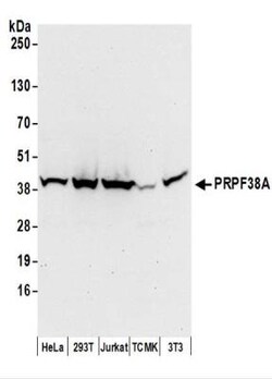 PRPF38A Antibody, Novus Biologicals 0.1mL:Antibodies, Polyclonal