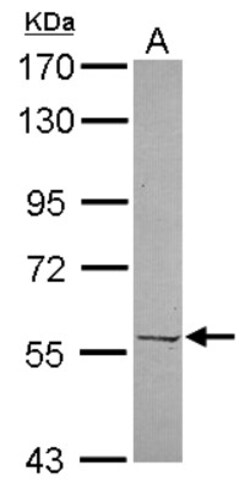 PRPF4 Antibody, Novus Biologicals 0.1mL; Unlabeled:Antibodies, Polyclonal
