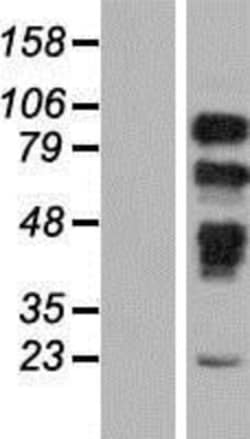 Novus Biologicals&trade;&nbsp;PRPF40B Overexpression Lysate