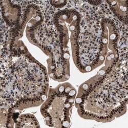 PRPF4 Antibody, Novus Biologicals:Antibodies:Primary Antibodies