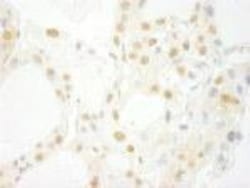 PRPF4B Antibody, Novus Biologicals 0.1mL; Unlabeled:Antibodies, Polyclonal