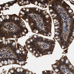 PRPF4B Antibody, Novus Biologicals:Antibodies:Primary Antibodies
