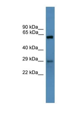 PRPK Antibody, Novus Biologicals 100&mu;L; Unlabeled:Anticuerpos