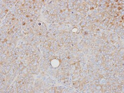 PRPS1 Antibody, Novus Biologicals 0.1mg; Unlabeled:Antibodies, Polyclonal