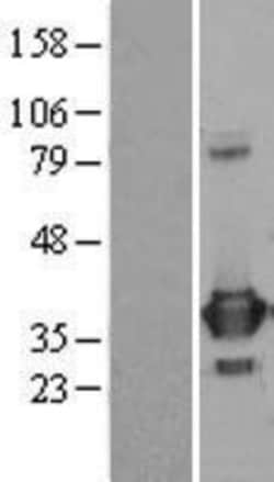 Novus Biologicals&trade;&nbsp;PRPS1 Overexpression Lysate