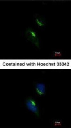 PRPS1 Antibody, Novus Biologicals 0.1mg; Unlabeled:Antibodies, Polyclonal