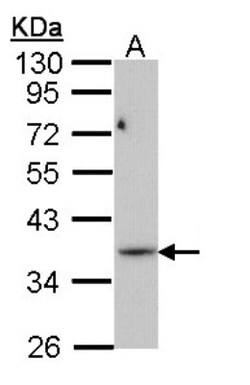 PRPS1L1 Antibody, Novus Biologicals 100 ul; Unconjugated:Antibodies, Polyclonal