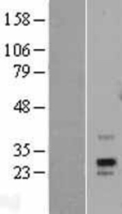 Novus Biologicals&trade;&nbsp;PRPS1L1 Overexpression Lysate