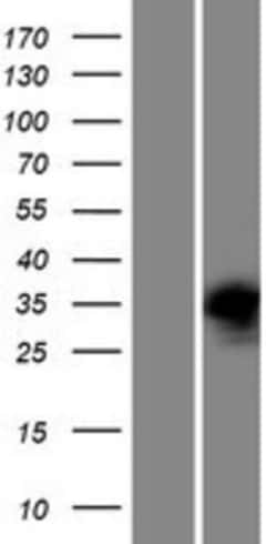 Novus Biologicals&trade;&nbsp;PRPS2 Overexpression Lysate