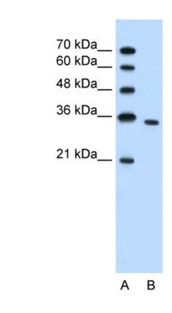 PRPS2 Antibody, Novus Biologicals 0.1mg; Unlabeled:Antibodies, Polyclonal