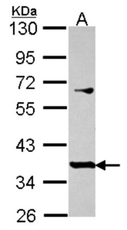 PRR11 Antibody, Novus Biologicals 0.1mL; Unlabeled:Antibodies, Polyclonal