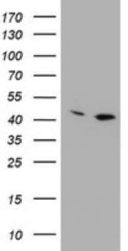 PRR11 Antibody (OTI2A10), Novus Biologicals 0.1mL; Unlabeled:Antibodies,