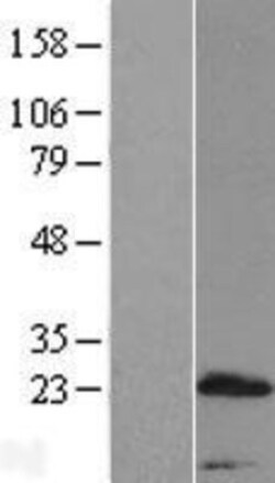 Novus Biologicals&trade;&nbsp;PRR15 Overexpression Lysate