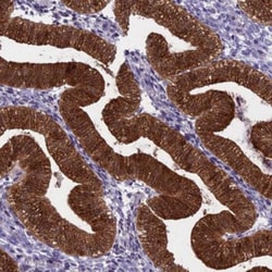 PRR15 Antibody, Novus Biologicals 25 &mu;L | Buy Online | Novus Biologicals | Fisher Scientific
