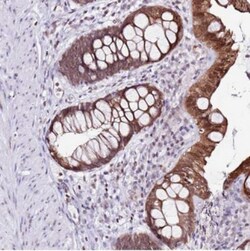 PRR15 Antibody, Novus Biologicals:Antibodies:Primary Antibodies