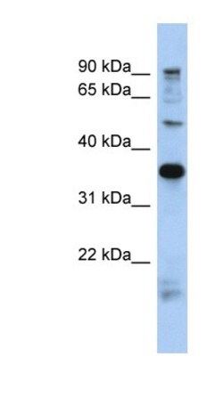 PRR19 Antibody, Novus Biologicals 100&mu;L; Unlabeled:Antibodies, Polyclonal