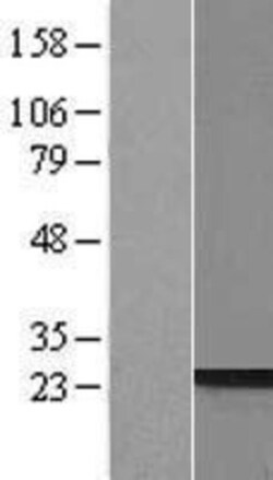 Novus Biologicals™ PRR3 Overexpression Lysate