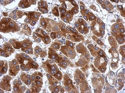 PRR5 Antibody, Novus Biologicals 0.1mL; Unlabeled:Antibodies, Polyclonal