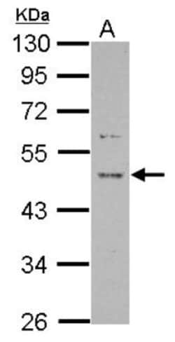 PRR5 Antibody, Novus Biologicals 0.1mL; Unlabeled:Antibodies, Polyclonal