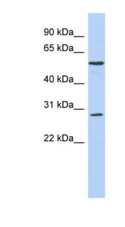 PRRC1 Antibody, Novus Biologicals 100 &mu;L | Buy Online | Novus Biologicals | Fisher Scientific