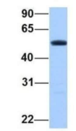 PRRC1 Antibody, Novus Biologicals 100 &mu;L | Buy Online | Novus Biologicals | Fisher Scientific