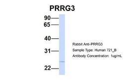 PRRG3 Antibody, Novus Biologicals 100&mu;L; Unlabeled:Antibodies, Polyclonal