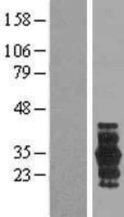 Novus Biologicals™ PRRG3 Overexpression Lysate
