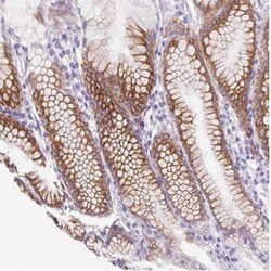 PRRT1 Antibody, Novus Biologicals 0.1mL; Unlabeled:Antibodies, Polyclonal