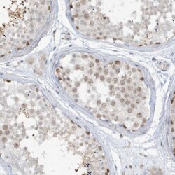 PRRT3 Antibody, Novus Biologicals 0.1mL; Unlabeled:Antibodies, Polyclonal